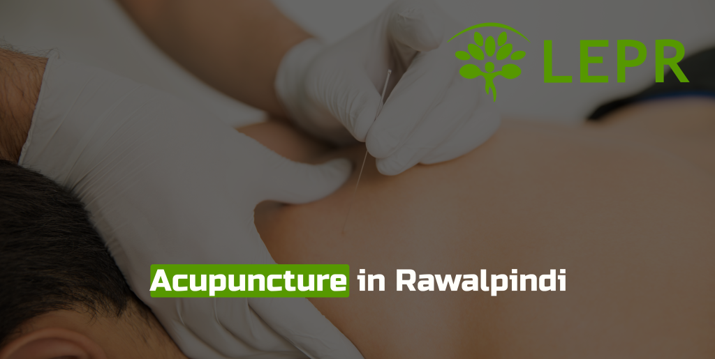 acupuncture in rawalpindi